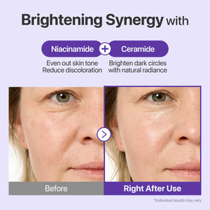 No. 9 NAD+ Retinol Volume Shot Eye Cream 20ml