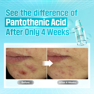 No.1 Pantothenic B5 Active Serum 50ml