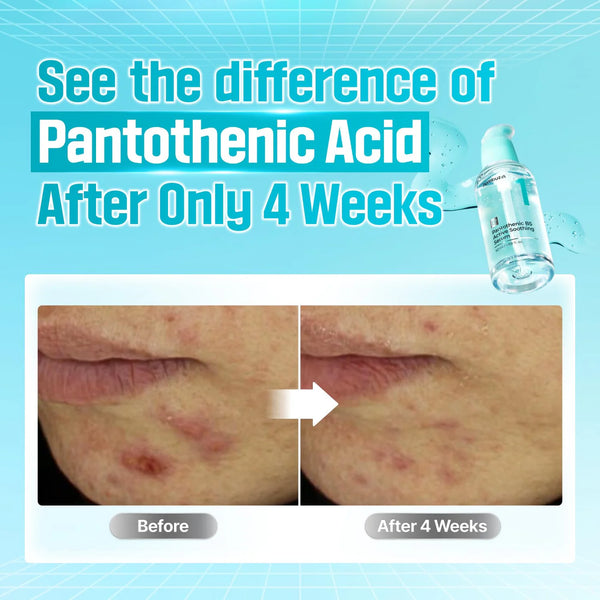 No.1 Pantothenic B5 Active Serum 50ml