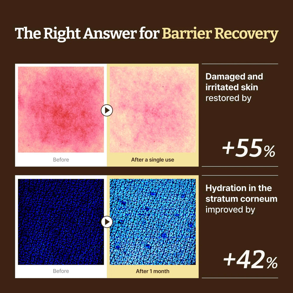 Advanced LC Ceramide Barrier Cream – 50ml