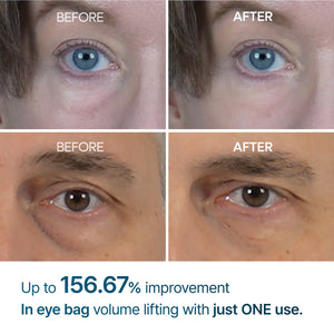 Eyephalt eyebag cream 10ml