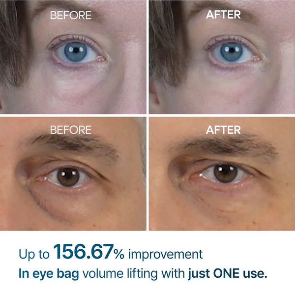 Eyephalt eyebag cream 10ml