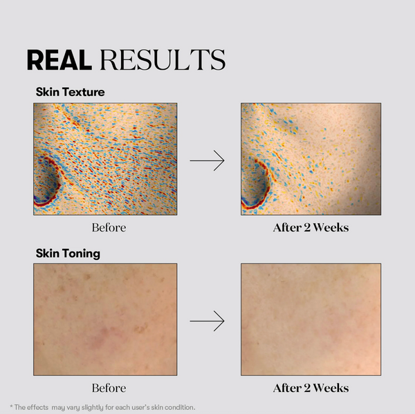 TX-Toning Daily Mask 30pcs