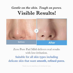 Zero Pore Pad Mild 70pads